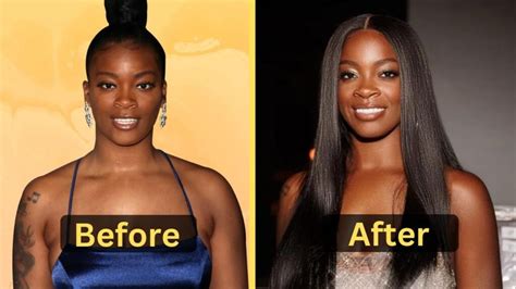 Ari Fletcher Before Surgery: Check out the Craziest Transformation